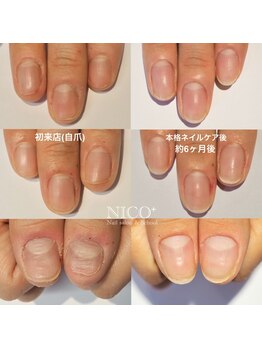 ニコプラス(NICO+)/爪育ネイルケア