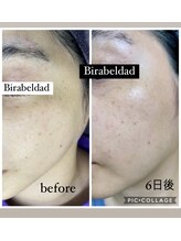 ビラ ベルダ(Bira Beldad)/