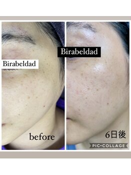 ビラ ベルダ(Bira Beldad)/