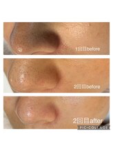 ウエカ(ueka)/綺麗な肌の土台を整えましょう♪