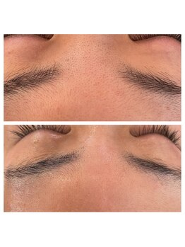 シェリモ(CHERIMO)/スーパーフードワックス1回