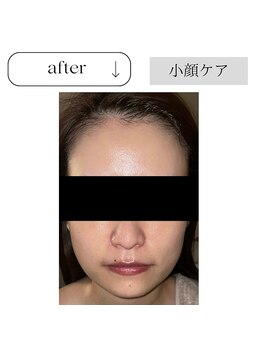 アイチューズ(ICHOOSE)/たった1回でこの引き締まり！