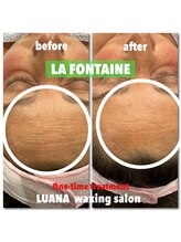 ルアナ ワックス サロン(LUANA Waxing Salon)/肌質改善ラフォンテフェイシャル