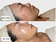 エングラッシー(en glassy)/BEFORE　AFTER　50代