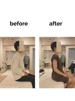 フィデル(fidele)/全身の筋緊張と姿勢改善例