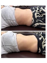 浜町しあわせ整体院/魔法の腸もみ