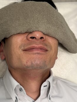 アトリエバンビ(atelier Bambi)/メンズ・ひげ脱毛＊