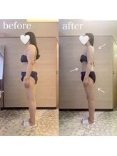 エステティックサロン アール 大阪梅田(esthetic salon R)/20代女性　横