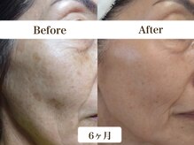 シェリー(cherie)