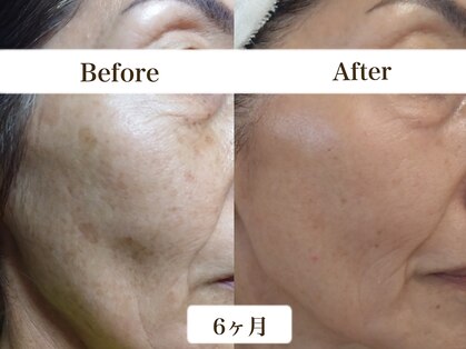 シェリー(cherie)の写真