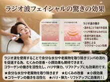 エトワール(etoile)/ラジオ波とは？