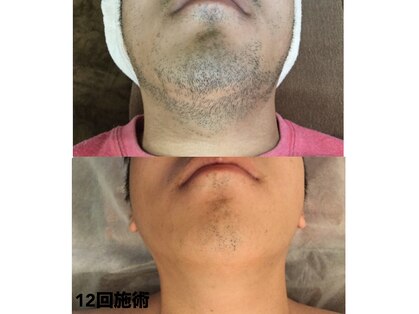 ルアナ(Luana)の写真