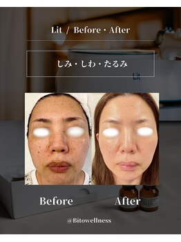 ビトウェルネス 池尻大橋(Bi to wellness)/【シミしわたるみ】肌育成