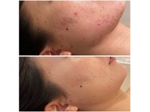 リモアボーテ(RIMOA beaute)の雰囲気(肌質改善フェイシャル/ゲリラSALE6,600円(トライアルキット付))