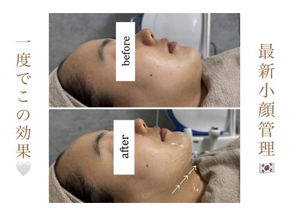 クレセント(crescent)の写真