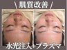 小顔×肌質改善★ノンニードル水光注入+ダーマプラズマエクソソーム¥7700