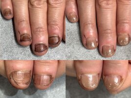 見た目が変わる驚き
