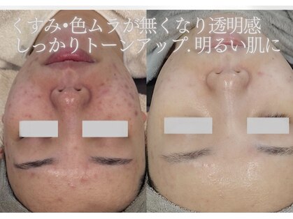 ルミエール 札幌大通parkside店の写真