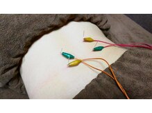 恵明堂の雰囲気（身体の鍼やブロック鍼もあります◎リンパ/肩こり/腰痛/美容鍼）