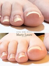 マリーロール 梅田店(Marie Laure)/自爪育成/深爪矯正/ネイルケア