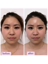 心奏(cocokana)/むくみゼロ