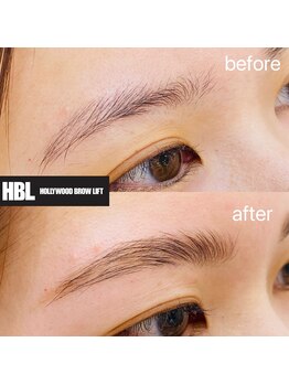 プルメリア(Plumeria)/眉〈ハリウッドブロウリフト〉