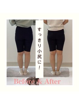 スタイルラボ高松/産後の骨盤矯正の効果♪