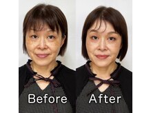 プリップ 中目黒(Pulip)/【50代お客様】ビフォーアフター