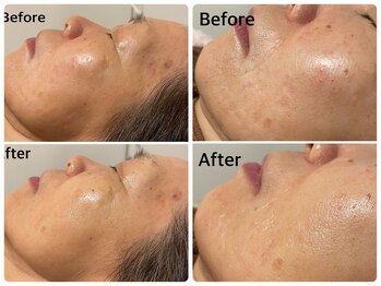 サロン ド ジョワ(salon de joie)/60代の効果