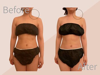 ファミーユ 名古屋店/【首肩こり、むくみケア】