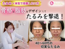 アンリエッタ(Unlieta)