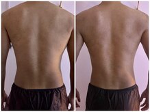 イーリバイブ/iNVYDOM MAX