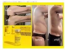 パリス 七尾店の雰囲気（話題のレモンボトル痩身韓国の溶剤だから結果がすごい！）