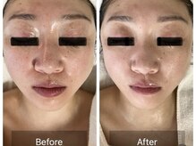 ミンク(Mink)の雰囲気（小顔むくみ解消！トーンUP！１度でも変化を感じる施術をご提供◎）