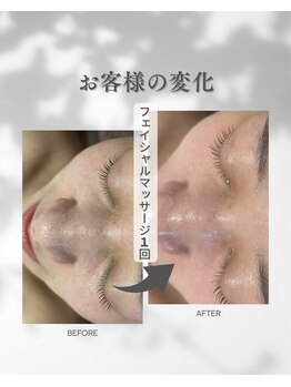 プレジール(Plaisir)/お手入れ1回
