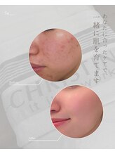 シャルム(Charme)