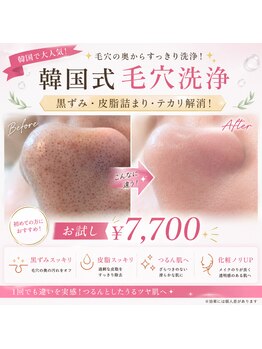 エミア(Emia)の写真/開き毛穴・毛穴シミ・毛穴の凹凸・毛穴の黒ずみ・毛穴のたるみなど、毛穴のお悩みご相談ください!!