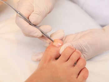 フットアンドネイルサロンレイナ(Reina)/B/S SPANGE(巻き爪ケア)