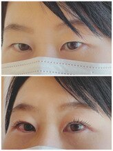 リボン アイラッシュアンドビューティーサロン(RIBBON)/＆ヘルシー120本