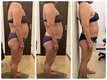 ビュップ 海老名店(美up)/【グロッティボディ】