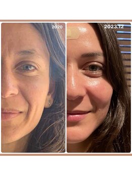 リラマ(Relama)/3年前よりもキレイに!