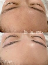 ルーズラッシュ リタアンドサン(Luu's LASH Rita&Sun)/フェイシャルワックスで毛穴レス