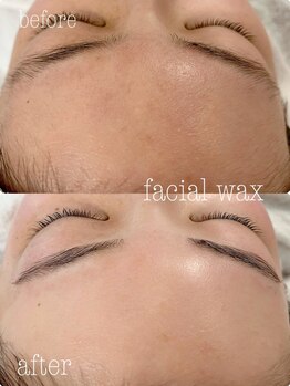 ルーズラッシュ リタアンドサン(Luu's LASH Rita&Sun)/フェイシャルワックスで毛穴レス