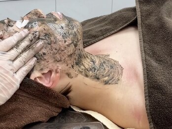 エルエルシー(L.L.C)の写真/【ハーブピーリングで集中ケア】ニキビケア/肌のゴワつき/目立つ毛穴/くすみに◎本格施術で自信のある肌へ
