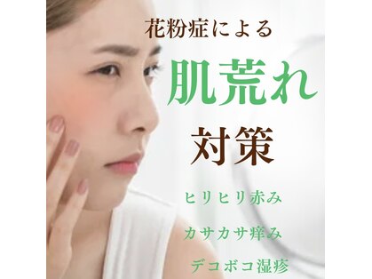 ユミの写真