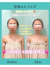 アコガレコガオ 鳥取店/コルギのビフォーアフター