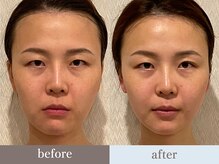 ビューティースタジオ韓美 渋谷店/お客様のbefore/after
