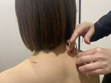 やさしい鍼灸院