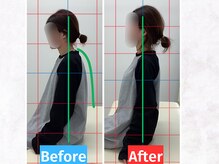 ナオル整体 仙台泉中央院(NAORU整体)/猫背改善