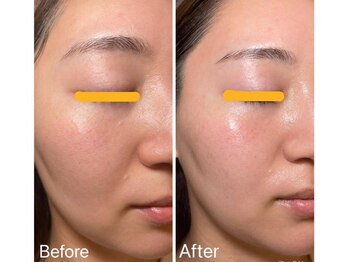 リュミエール デスポワール(Lumiere d'espoir)/白玉ピコ+プラズマ